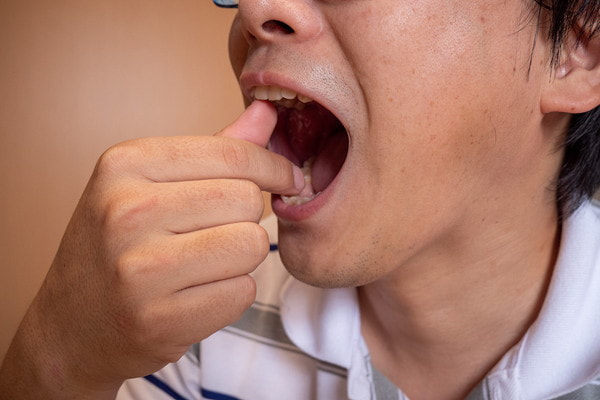 西馬込（大田区）の歯医者、なおい歯科クリニックの顎関節症