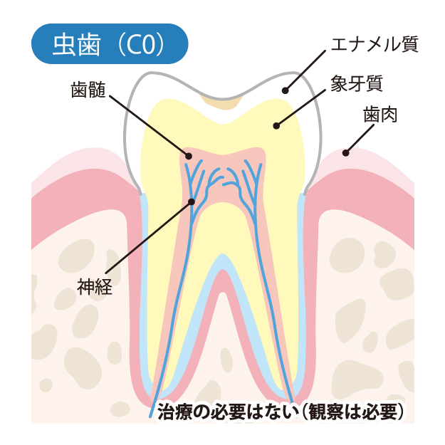 堺市西区の歯医者さん、諏訪ノ森歯科・矯正歯科の一般歯科