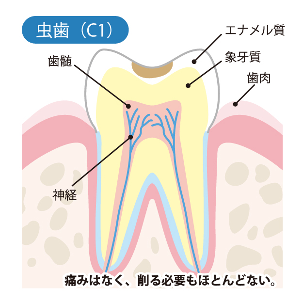 堺市西区の歯医者さん、諏訪ノ森歯科・矯正歯科の一般歯科