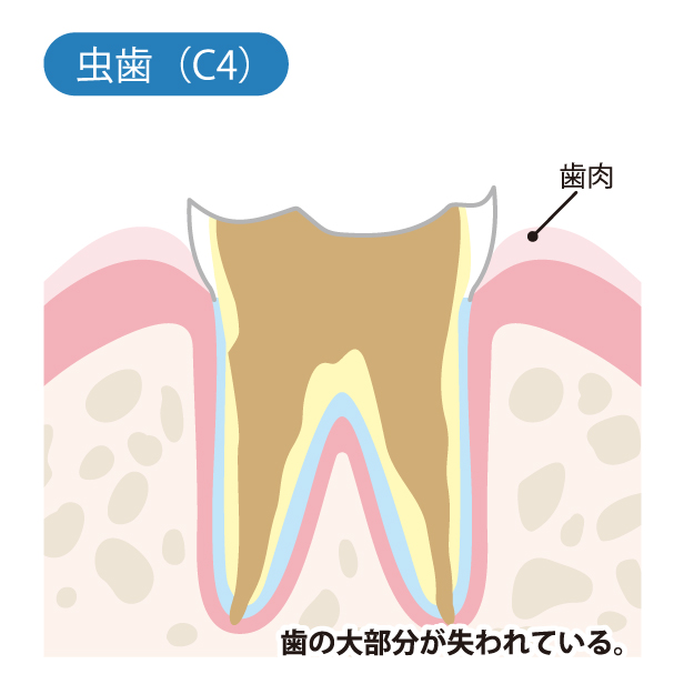 堺市西区の歯医者さん、諏訪ノ森歯科・矯正歯科の一般歯科