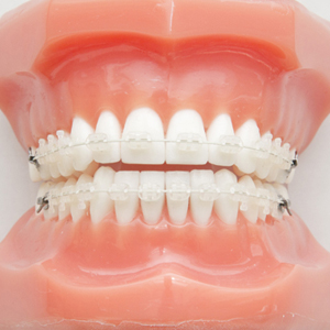 西馬込（大田区）の歯医者、なおい歯科クリニックの矯正治療