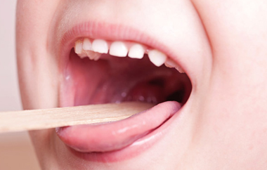 西馬込（大田区）の歯医者、なおい歯科クリニックの矯正治療