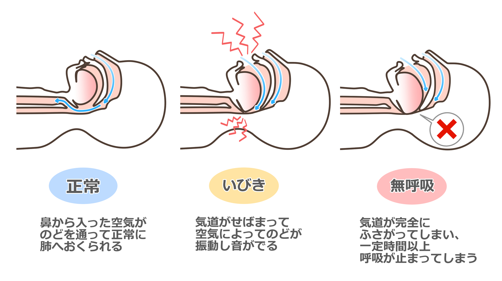 堺市西区の歯医者さん、諏訪ノ森歯科・矯正歯科でおとなの体質改善